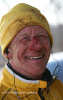 photo of Keith Dowell's bloody nose